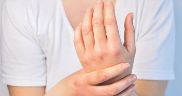 col for hands - anka blog
