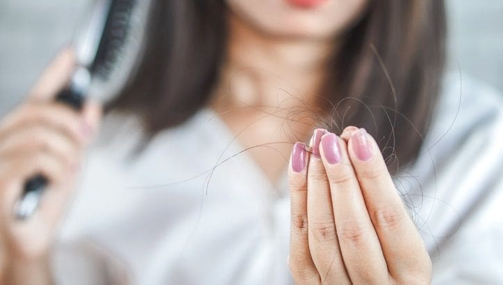 ANDROGENETSKA ALOPECIJA KOD ŽENA